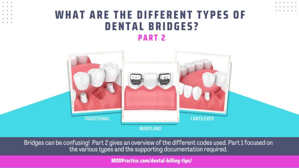 HOW TO CODE DENTAL BRIDGES